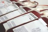 Fresh red blood cells add no advantages for critically ill